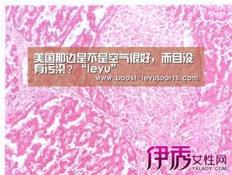 美国那边是不是空气很好,而且没有污染?“leyu”(图1) 美国那边是不是空气很好,而且没有污染?“leyu”(图1)